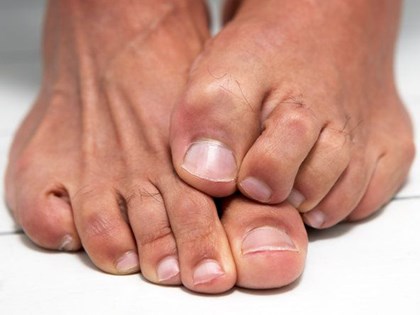 Athlete’s Foot Bath